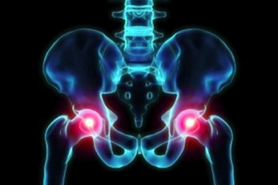 Riabilitazione per protesi all'anca